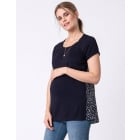 Print Back Maternity & Nursing Top